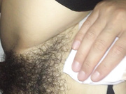 炮友刚做完手术就迫不及待被大鸡巴插入